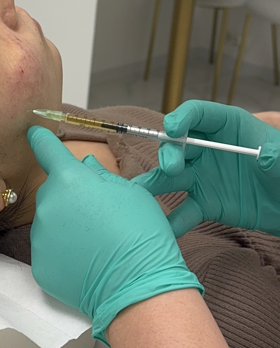 PRP behandeling Clinic Essence