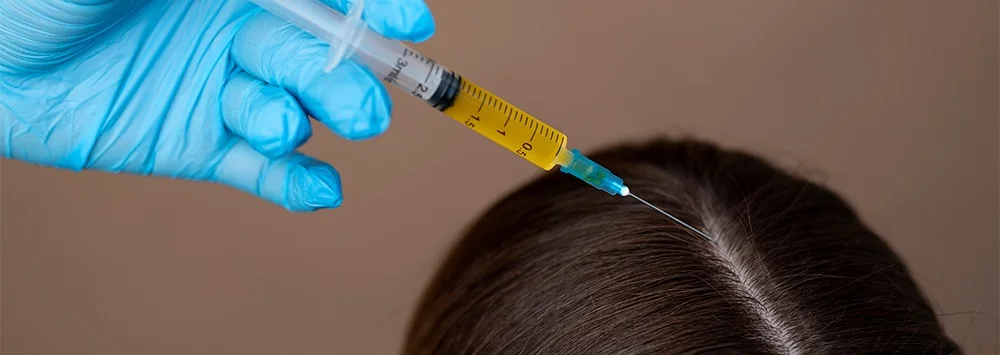 PRP haar behandeling Clinic Essence