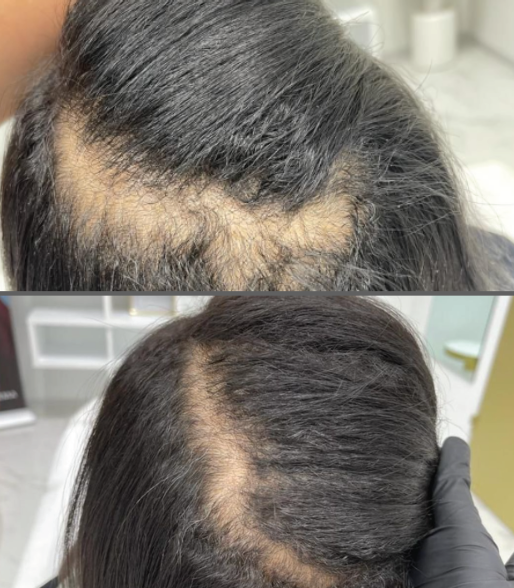 XL Hair behandeling Clinic Essence