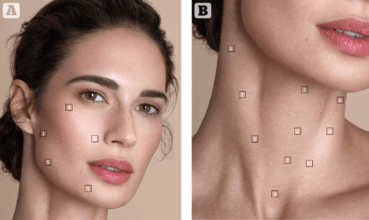 Profhilo skinbooster behandeling Clinic Essence