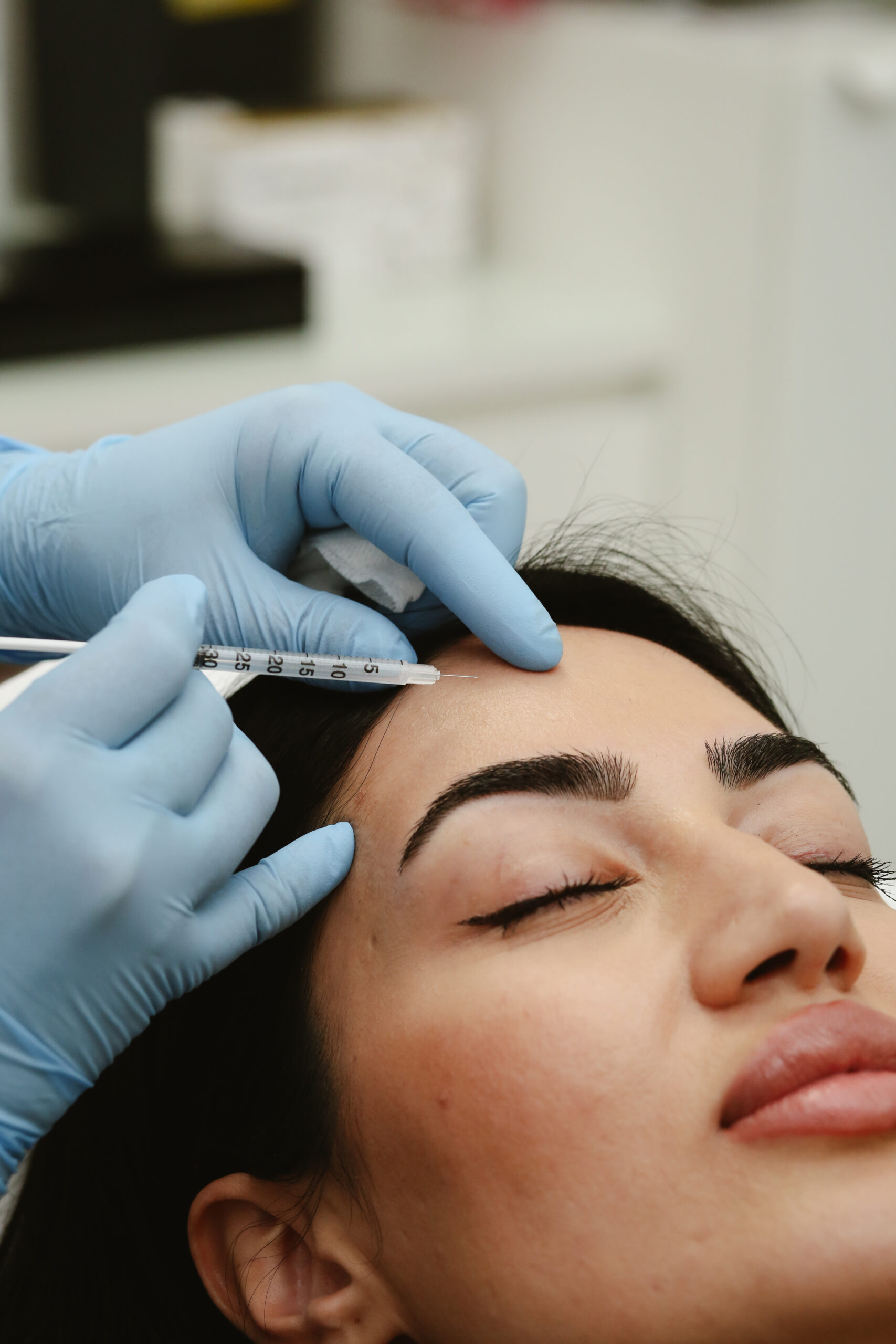 Voorhoofdrimpels behandeling Clinic Essence